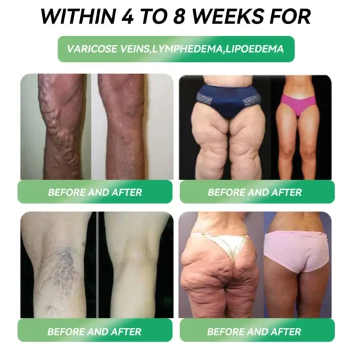 𝐖𝐚𝐫𝐦𝐅𝐚𝐦𝐢𝐥𝐲® 𝐆𝐋𝐏-𝟏 𝐖𝐞𝐢𝐠𝐡𝐭 𝐋𝐨𝐬𝐬 𝐎𝐫𝐚𝐥 𝐒𝐨𝐥𝐮𝐭𝐢𝐨𝐧