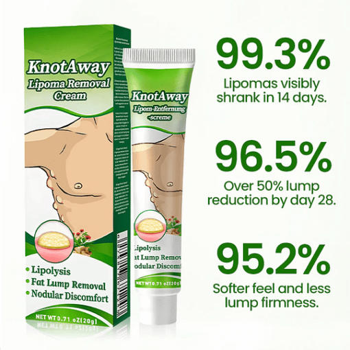 AnnieCare® KnotAway Lipoma Removal Cream - Image 3