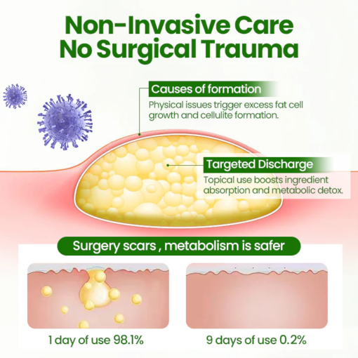 AnnieCare® KnotAway Lipoma Removal Cream - Image 4