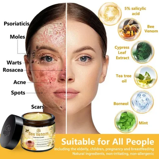 AnnieCare® Bee Venom Skin Treatment Cream - Image 2