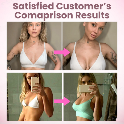 Anniecare® Breast Enhancement Nano Patch - Image 2