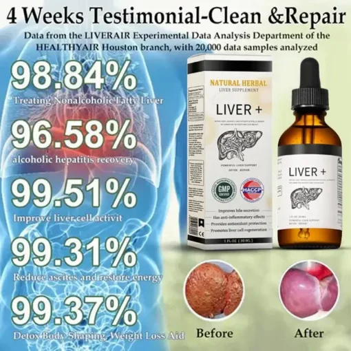 𝑨𝒏𝒏𝒊𝒆𝑪𝒂𝒓𝒆® 𝐍𝐚𝐭𝐮𝐫𝐚𝐥 𝐇𝐞𝐫𝐛𝐚𝐥 𝐋𝐢𝐯𝐞𝐫 𝐒𝐮𝐩𝐩𝐥𝐞𝐦𝐞𝐧𝐭 - Image 2