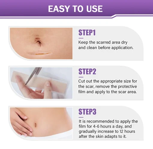 AnnieCare® Hyaluronic Acid Nano Microneedle Repair Tape - Image 3