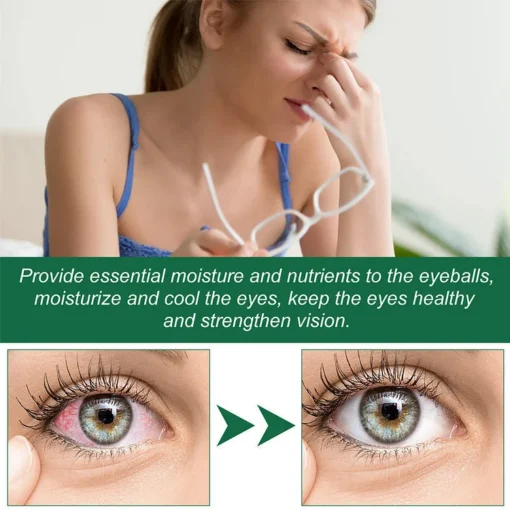 AnnieCare® Presbyopia Eye Drops - Image 4