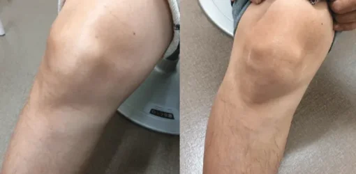 AnnieCare® BeeVenom Joint Repair Cream - Image 3