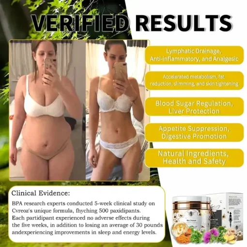 AnnieCare® Bee Venom Lymphatic Drainage & Skin Firming Slimming Cream - Image 2