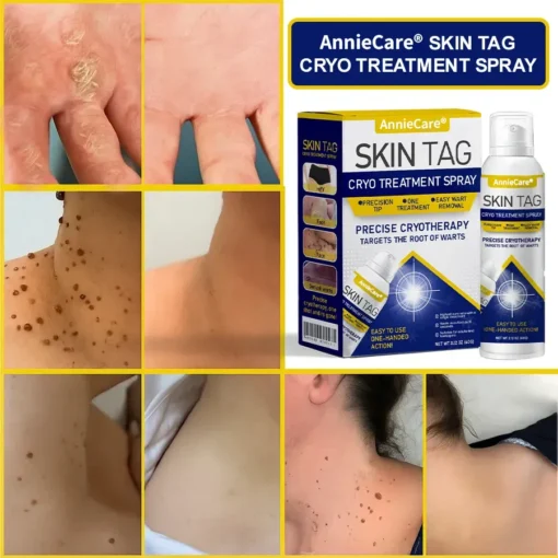 AnnieCare® Skin Tag Cryo Treatment Spray - Image 2