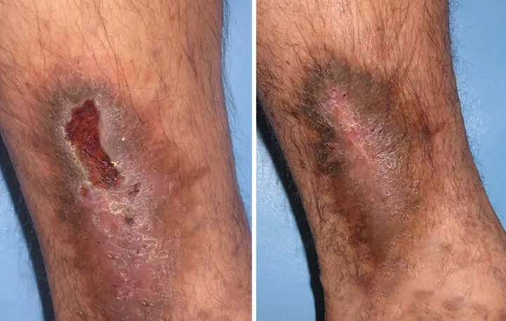 AnnieCare® GlucoRelix Diabetes Treatment Softgels - Image 4