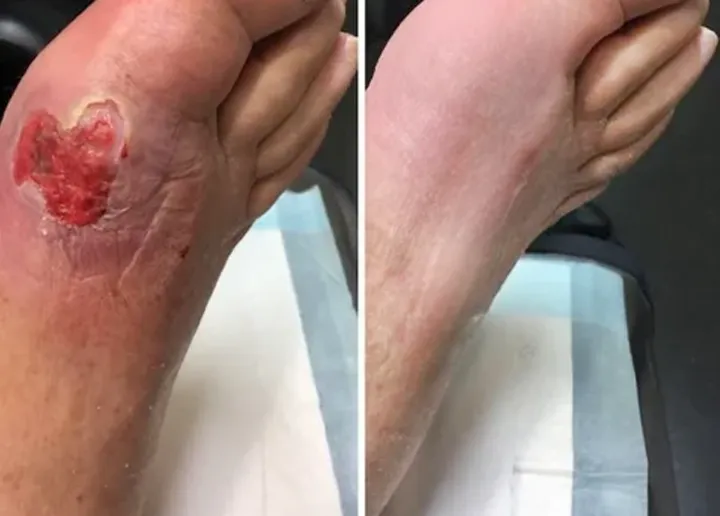 AnnieCare® GlucoRelix Diabetes Treatment Softgels - Image 3