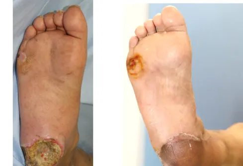 AnnieCare® GlucoRelix Diabetes Treatment Softgels - Image 2