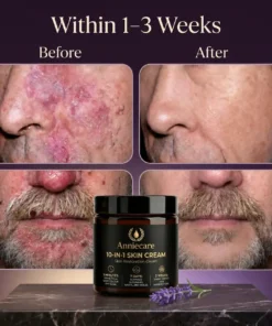 Anniecare 10-in-1 Skin Restoration Cream
